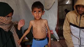 Israel's border closure leaves Gaza children like Osama fighting to survive amid growing crisis