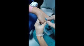 Técnica de canalización de vena periférica básica y fijación correcta del catéter venoso, según los recursos que tengamos. Video educativo para el personal de enfermería y quien trabaje con administración de medicamentos venosos y muchos más.