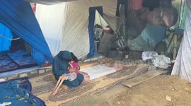 Gaza girl’s fight for life reveals a generation’s silent hunger (1)