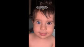 kiron bebé de argentina con heterocromia.