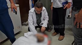Palestinian father who lost 9 children in Israeli airstrike dies of injuries