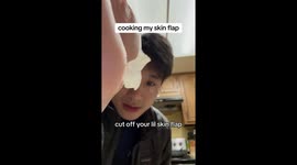 Breakdancer turns injury into shock-cooking experiment when he fries his own skin