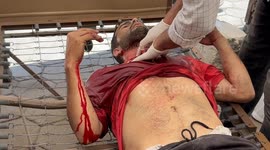 وصول إصابات جراء استهداف  لمنزل عائلة عسلية بينهم أطفال ونساء الي مستشفي المعمداني بجوار  المسجد العمري في جباليا البلد شمال غزة