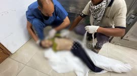 Another Palestinian dies of malnutrition in Gaza amid Israel’s stifling siege