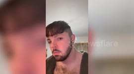 Man's head swells after he ignored 'no sex' rule following Turkey hair transplant