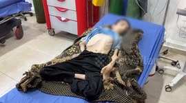 ‘He died in front of us’: Gaza family mourns son lost to starvation amid growing famine