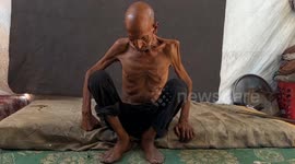 75-year-old man in Gaza drops to 40 kilograms amid Israeli-imposed starvation