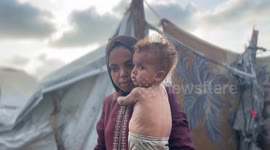 Malnourished Palestinian toddler in Gaza at risk amid Israeli blockade