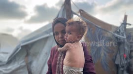 Malnourished Palestinian toddler in Gaza at risk amid Israeli blockade