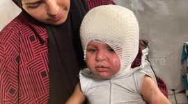 Palestinian toddler with severe burns denied critical care under Gaza blockade