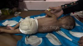 Two-month-old malnourished Gaza infant fights for life as family pleads for treatment abroad