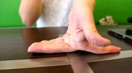 Have you ever seen banding fingers like this?