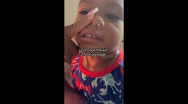 Mother helps remove tiny toy from boy’s nose in Charlotte, North Carolina, USA