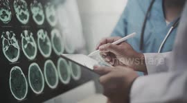 UNCAPTIONED: Study Links Heavy Alcohol Consumption To Brain Damage And Increased Stroke Risk