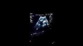 Meeting Our Grandson: An Emotional Ultrasound Experience