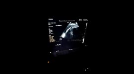 A Grandson's Debut: An Unforgettable Ultrasound Reveal