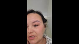 Dog Brings Home His Own Pet Hedgehog