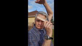 Man Impales Himself With a Rat Tail Comb