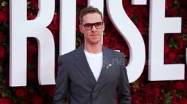 UNCAPTIONED: Benedict Cumberbatch reveals shoulder surgery