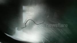 Surgeons remove unpleasantly long parasite from boy's head in China