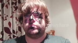 Covered in Soot After Krampus Run