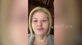 Woman's lip torn off in freak attack by 