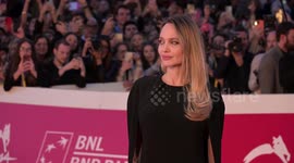 UNCAPTIONED: Angelina Jolie displays mastectomy scars for first time