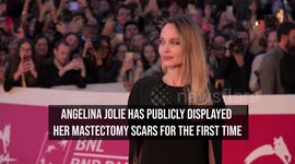 NEWS OF THE WEEK: Angelina Jolie displays mastectomy scars for first time