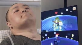 China: Chinese scientists complete clinical trial of brain-computer interface product