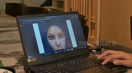 Woman whose facial fillers went wrong has had swollen features for two years