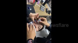 China: Chinese office worker had eye drop cap ring fall off during application