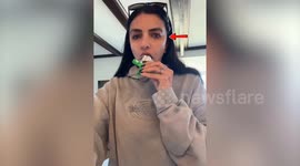 'Rare syndrome makes my eye 'bulge' when I chew food - and I love it'