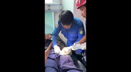 Firemen remove ring stuck on patient's finger in Indonesia