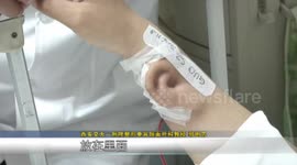 Doctors grow ear on man's arm after he lost an ear in an accident